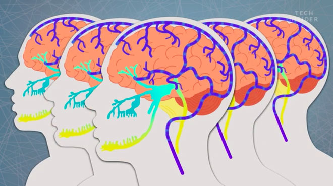 Picture 2 of 'Eastern brain' - strange phenomenon but a lot of people have experienced it