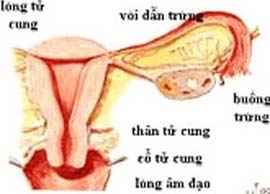 Picture 1 of Ectopic pregnancy: Can be prevented