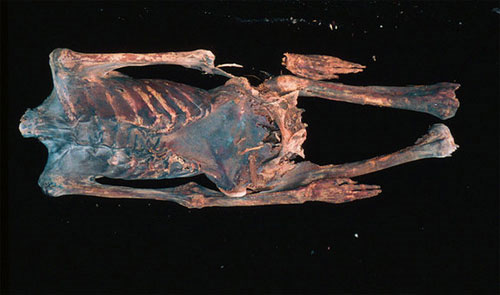 Picture 1 of Egyptian mummy revealed the pollution in ancient times