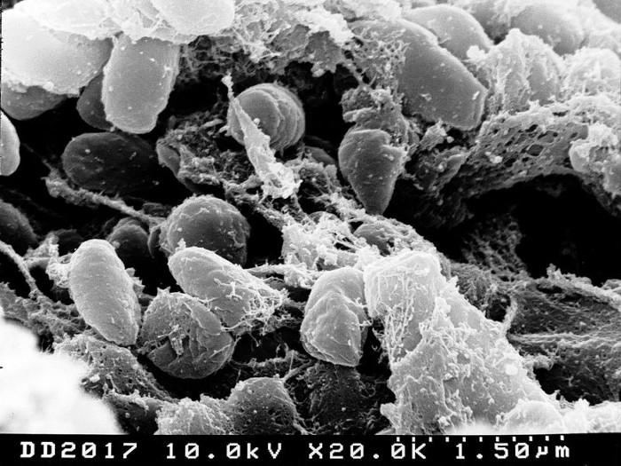 Picture 2 of El Niño will make the bacterial community migrate across the continent
