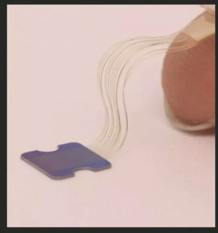 Picture 4 of Elon Musk invested hundreds of millions of dollars to 'chip' the chip into the human brain