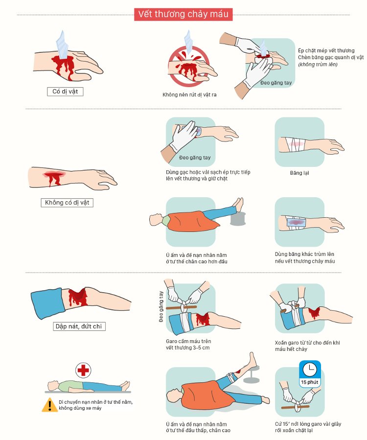 Picture 2 of Emergency management manual for common accidents