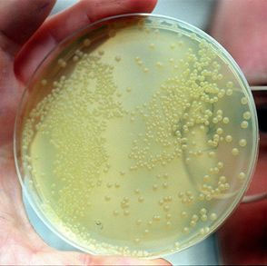 Picture 1 of English: The level of e.coli contamination in clean water supplies increases 5 times