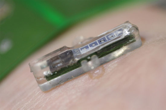 Picture 1 of Equipment tiny blood tests under the skin