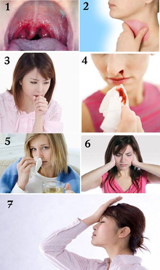 Picture 3 of Essential knowledge about throat cancer