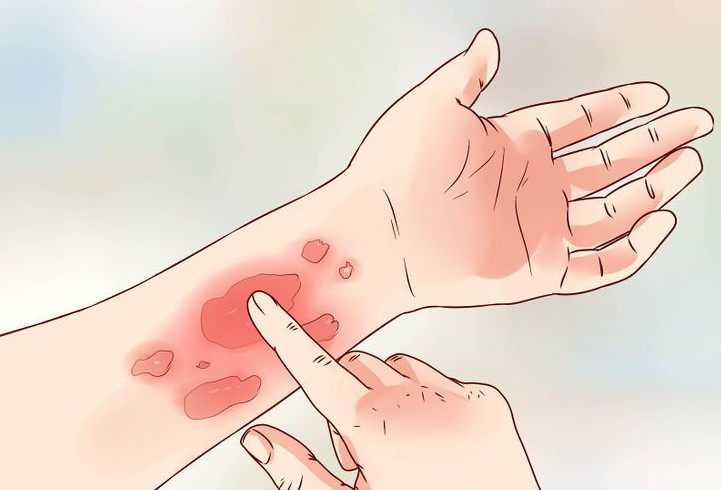 every-winter-there-is-a-phenomenon-of-skin-itching-due-to-these-causes