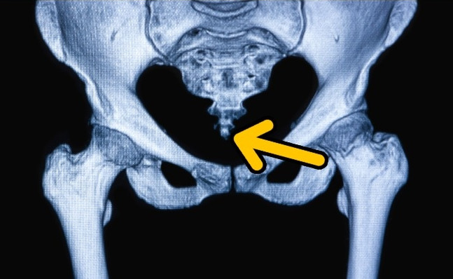 Picture 1 of Everyone owns this part on the body but don't know why they exist