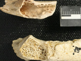 Picture 1 of Evidence of cancer in Neanderthals