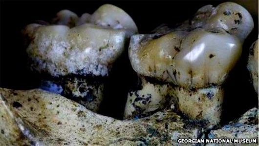 Picture 1 of Evidence shows that the ancients knew how to use toothpicks to