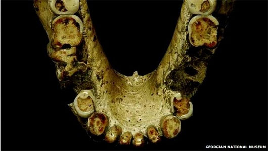 Picture 2 of Evidence shows that the ancients knew how to use toothpicks to