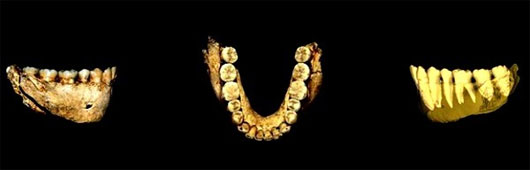 Picture 3 of Evidence shows that the ancients knew how to use toothpicks to