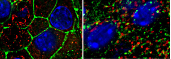 Picture 1 of Excess fat diet causes type 2 diabetes