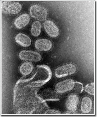 Explain the spread of flu in 1918 images 1