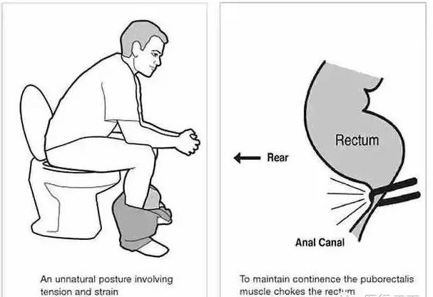 Picture 5 of Explaining the cause makes it difficult for you to