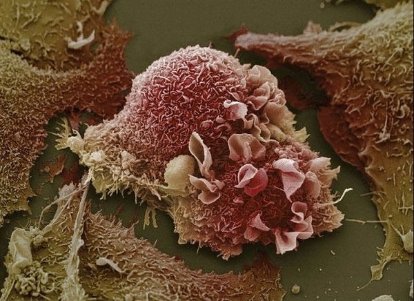 Picture 10 of Extremely interesting images of the human body