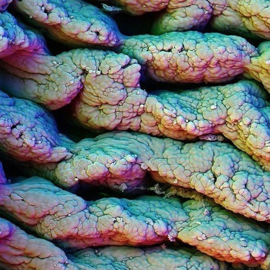 Picture 11 of Extremely interesting images of the human body