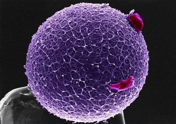 Picture 12 of Extremely interesting images of the human body