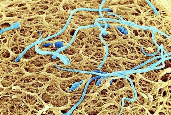 Picture 13 of Extremely interesting images of the human body