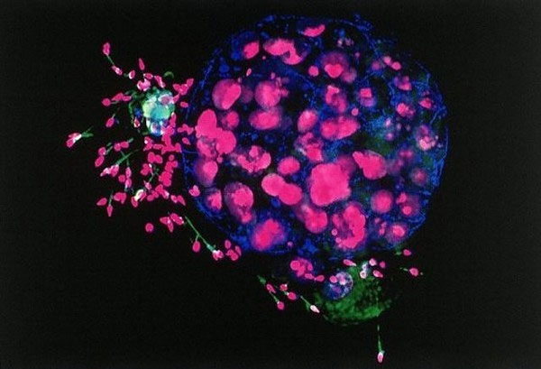 Picture 14 of Extremely interesting images of the human body