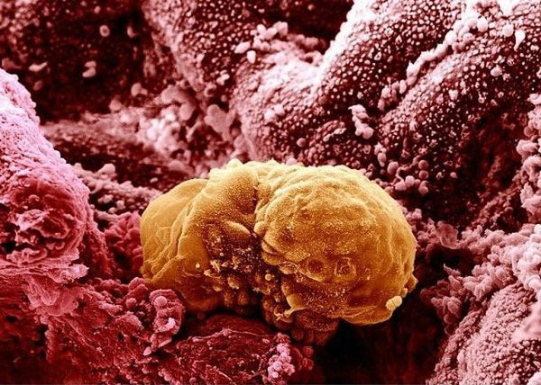 Picture 15 of Extremely interesting images of the human body