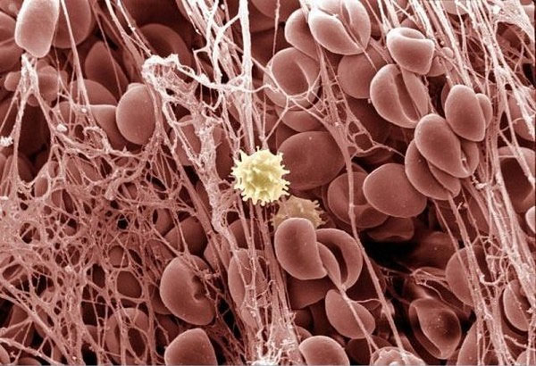 Picture 8 of Extremely interesting images of the human body