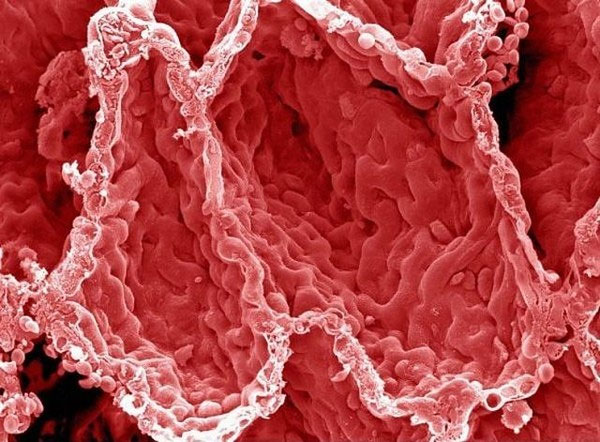 Picture 9 of Extremely interesting images of the human body