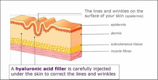 Picture 6 of Face lift technology from ancient to modern