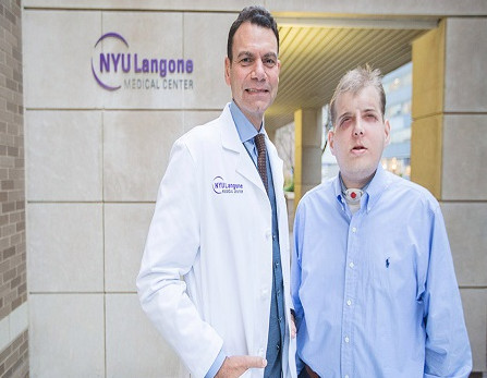 Picture 2 of Face transplants startling the world