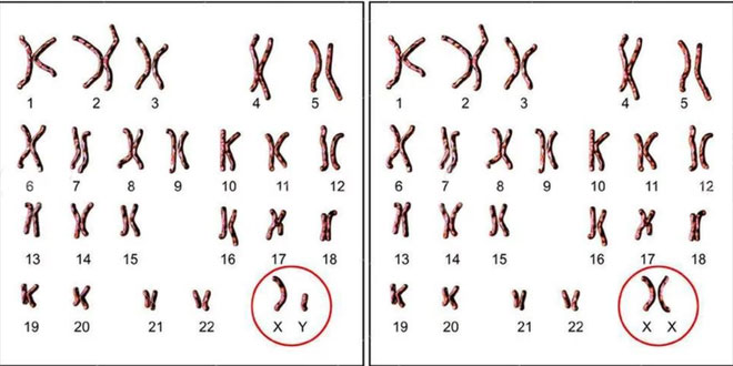 Female Is Xx Male Is Xy But Why Not Have Yy Chromosome