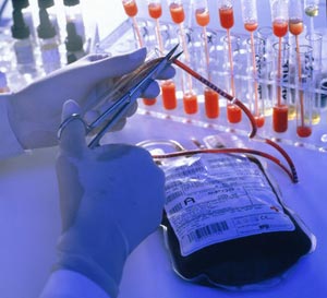 Picture 1 of Filter blood lead with a magnetic field