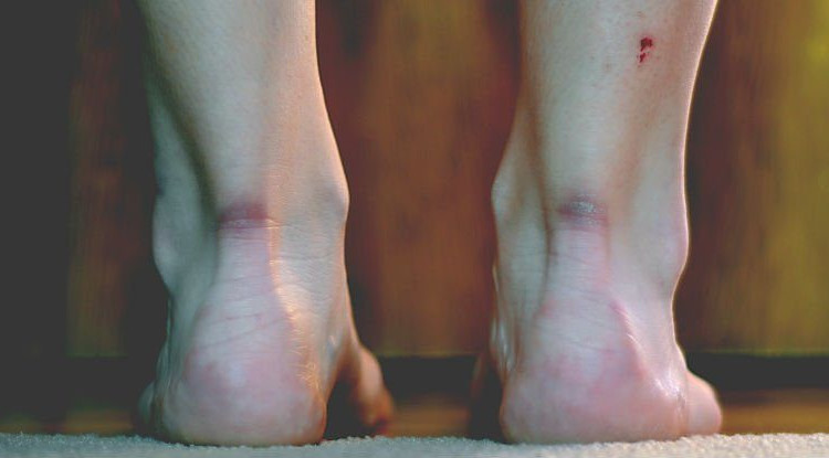 Picture 1 of Finally science also found a way to heal without leaving a scar
