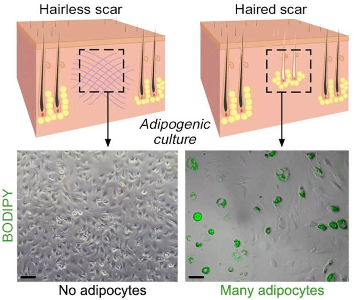 Picture 2 of Finally science also found a way to heal without leaving a scar