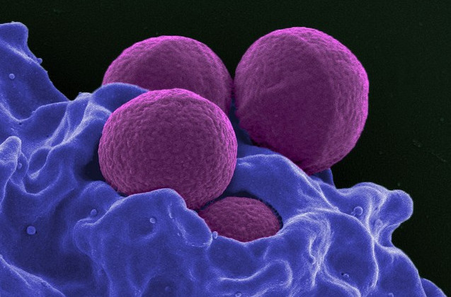 Picture 1 of Find a way to kill bacteria in a completely new body