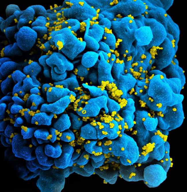 Picture 1 of Find new antibodies, disable 98% of the HIV / AIDS gene sequence