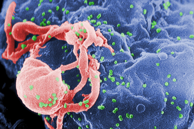 Picture 2 of Find new antibodies, disable 98% of the HIV / AIDS gene sequence