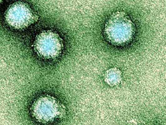 Picture 1 of Find new vaccines against chikungunya virus