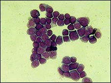 Picture 1 of Find out the genetic map of cancer