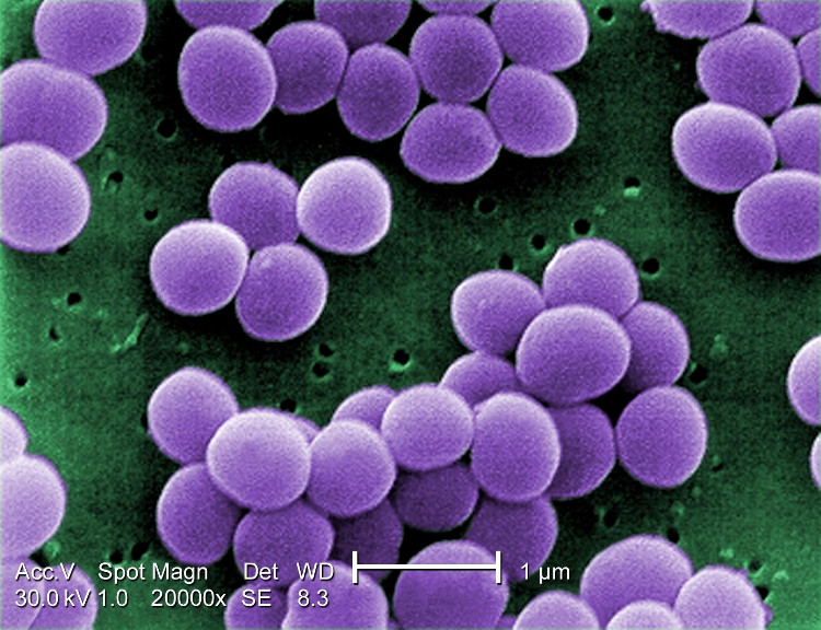 Picture 1 of Find out which compound helps kill 98% of an antibiotic-resistant bacterium from sponges