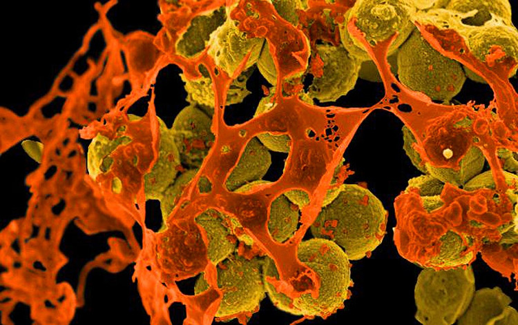 Picture 4 of Find out which compound helps kill 98% of an antibiotic-resistant bacterium from sponges