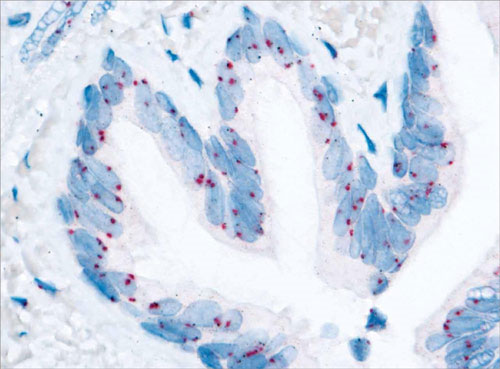 Picture 1 of Find the clues that cause cancer resistance