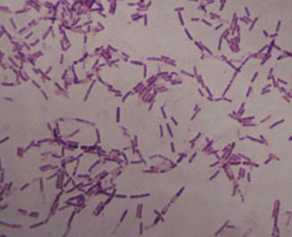 Picture 1 of Find the key of immortality from bacteria living 3.5 million years ago
