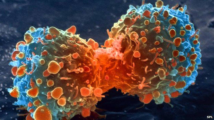 Picture 1 of Find the safest cancer test method ever