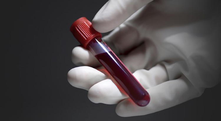 Picture 2 of Find the safest cancer test method ever