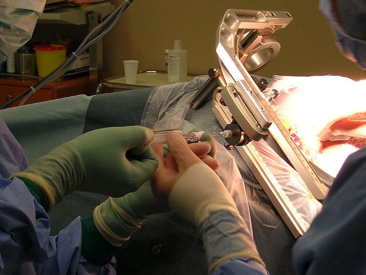 Picture 3 of Find the safest cancer test method ever