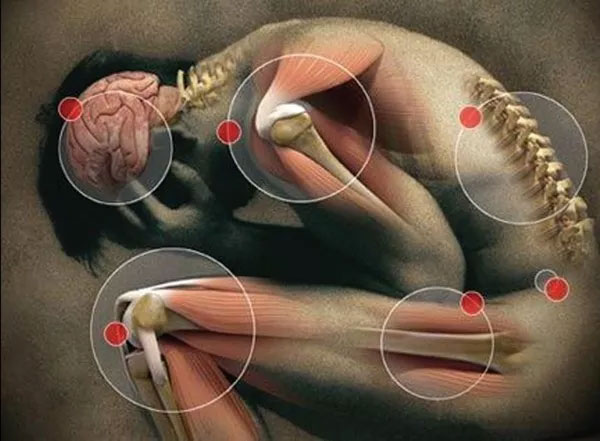 Picture 1 of Find the worst pain people can endure