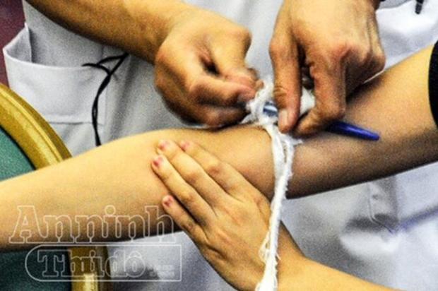 Picture 8 of First aid procedure for vascular wound caused by cutting, or sharp pointed object