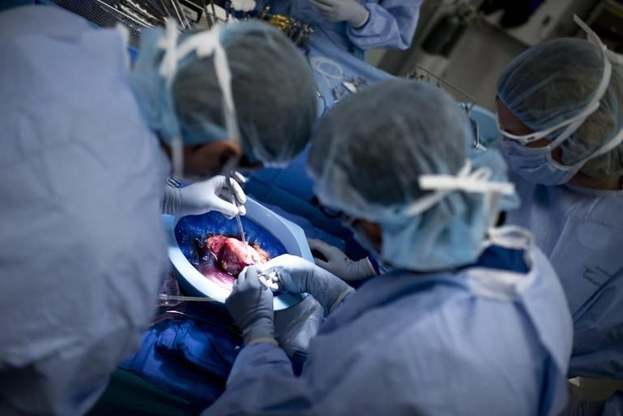 Picture 1 of First organ transplant for HIV-infected people