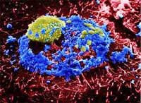 Picture 2 of First published photo of avian influenza virus