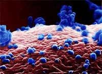 Picture 3 of First published photo of avian influenza virus