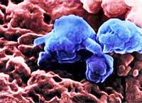 Picture 4 of First published photo of avian influenza virus